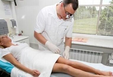 Varikozės venų diagnozė
